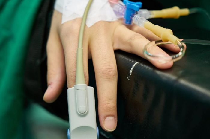 11 symbolic meanings of dreaming about anesthesia